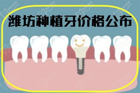 潍坊种植牙多少钱一颗2022价格表公布,种牙好的医院就是这几家_口腔行业资讯_皓齿口腔网