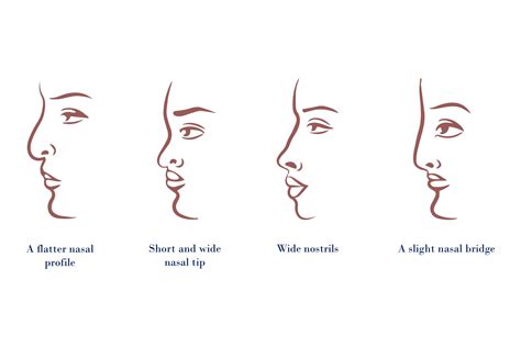 Achieve Your Desirable Nose Shape With Korean Rhinoplasty | Dream ...