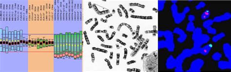 Medical Genetics, SGPGIMS
