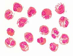 Image result for 嗜酸性细胞