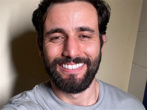 Ex-BBB Matteus Amaral mostra resultado de harmonização facial | O TEMPO