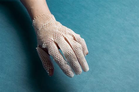 Kerecis Announces New Fish-Skin Burn Products - Kerecis