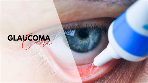 Glaucoma Specialist in Delhi | Best Glaucoma Hospital in India- Bharti Eye Hospital