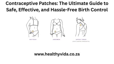 Contraceptive Patches: The Ultimate Guide to Safe, Effective, and Hassle-Free Birth Control ...