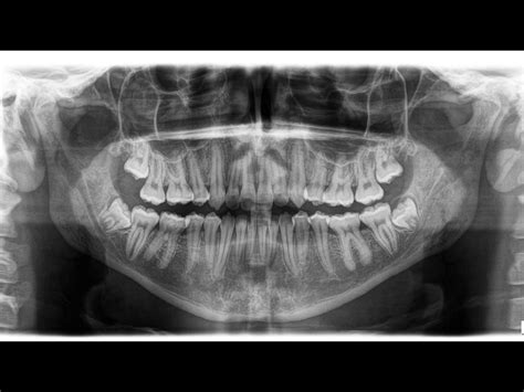 Image result for Creating a Representative Ensemble through Computer Simulation