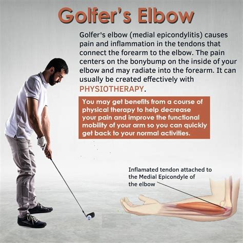 Golfer's elbow (medial epicondylitis) causes pain and inflammation in the… | Dr Natasha khanna