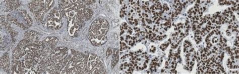 Anti-Wee1 from rabbit, purified by affinity chromatography | Sigma-Aldrich