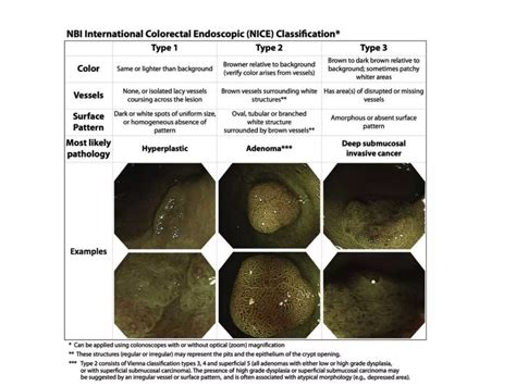 EMR/ endoscopic mucosal resection | PPTX
