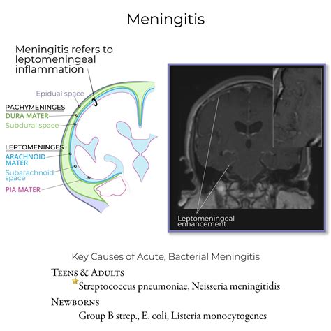 Clinical Pathology Glossary: Meningitis | ditki medical & biological ...