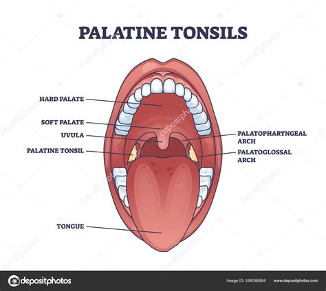 Diagrama De Tonsila Lingual Tonsillitis – Zero To Finals
