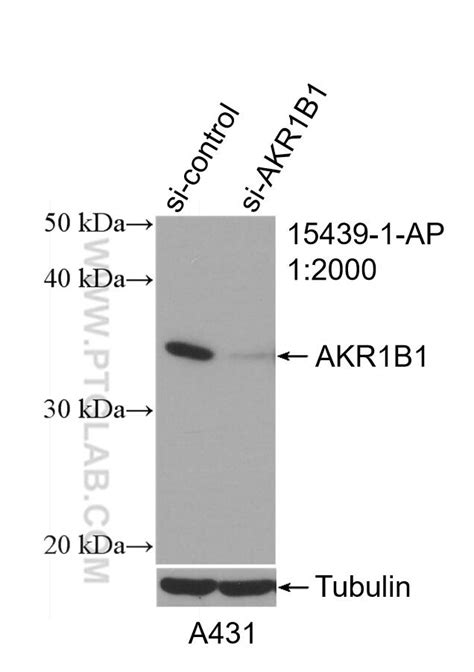 AKR1B1 antibody (15439-1-AP) | Proteintech