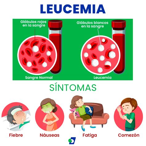 Sintomas De Leucemia