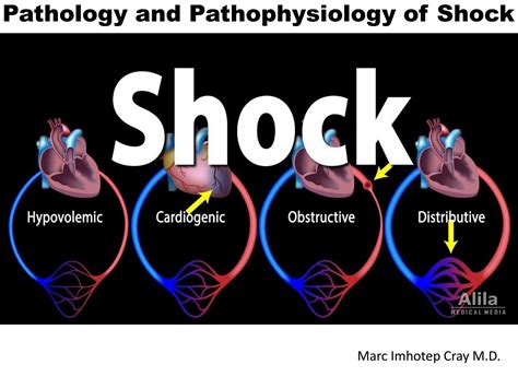Shock Pathophysiology 的图像结果