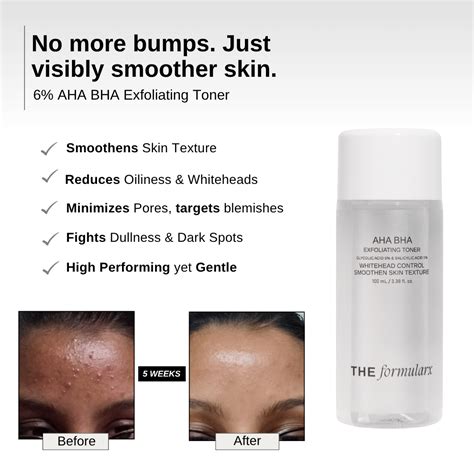 6% AHA BHA Exfoliator- 5% Glycolic + 1% Salicylic acid I Oil & Pore ...