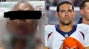 Mark Sanchez's 69-Year-Old Assault Victim May Have Committed Major No ...