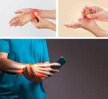 A Comprehensive Guide to Surviving Smartphone-Induced Pains or Smartph ...