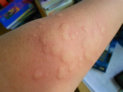 Image result for Alien Bursts From Stomach