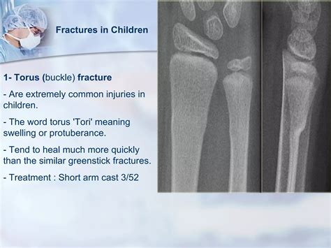 Fractures Of The Distal Radius | PPT