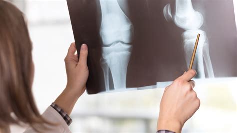 Helios International — Official Helios Website for International Patients