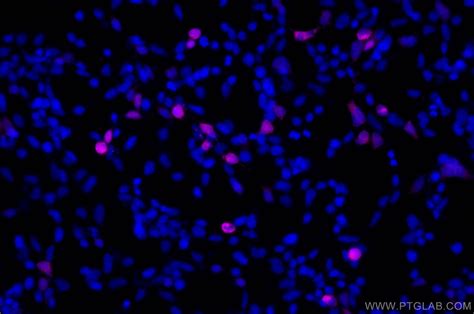 GFP tag antibody (CL647-66002) | Proteintech