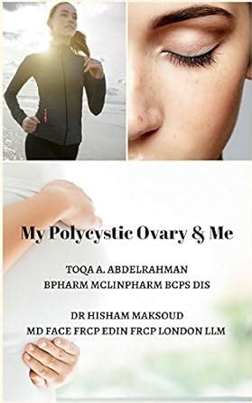 My Polycystic Ovary & Me: PCOS Diet, Fertility and PCOS, Managing PCOS ...