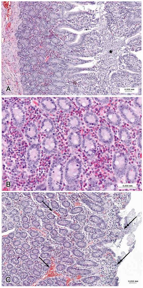 Oral Exposure to Microplastics Affects the Neurochemical Plasticity of ...