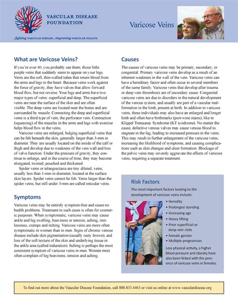 Varicose-veins-flyer. It's a lymp issues related with vein - Msc ...