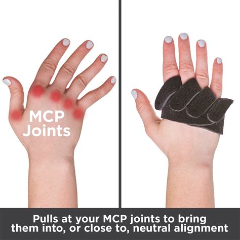 BraceAbility Ulnar Deviation Hand Splint - MCP Knuckle Support Brace ...