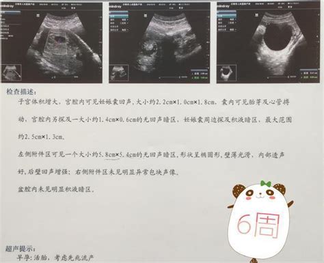 怀孕约6周，HCG跟孕酮以及B超是否正常？ - 百度宝宝知道