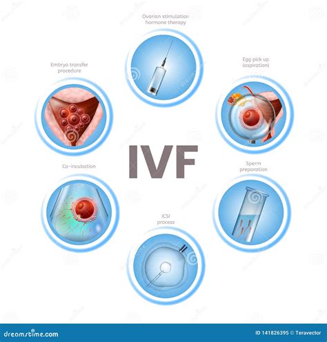 Stages Of In Vitro Fertilization Medical Banner Vector Illustration | CartoonDealer.com #145358656