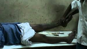 Puttur Kattu in Rachapalem Village of Andhra, Traditional Bone Setting