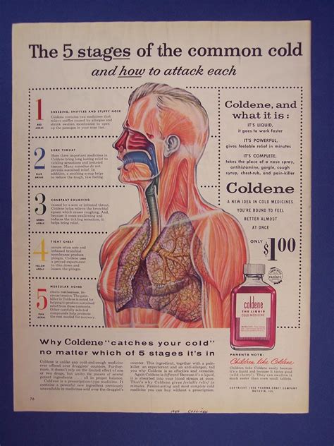 Amazon.com: coldene,the 5 stages of the common cold, Print Ad,vintage Magazine Print Art: Home ...