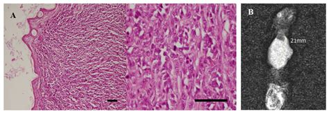 Glucosamine-Modified Mesoporous Silica-Coated Magnetic Nanoparticles: A ...