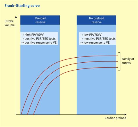 Hypovolaemia - Anaesthesia & Intensive Care Medicine