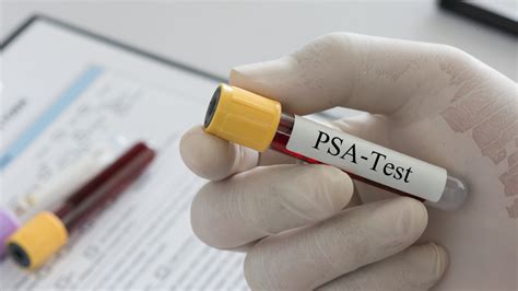 Prostate Cancer Screening In UK To Focus On High-Risk Men; Guidelines ...