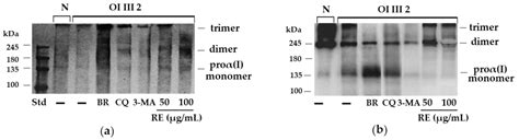 Rosemary Extract-Induced Autophagy and Decrease in Accumulation of ...