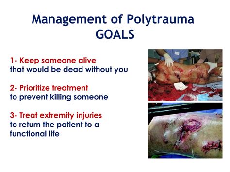 Polytrauma part 7 (Management) | PPT