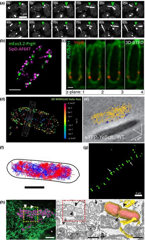 Image result for Super-Resolution Microscopy
