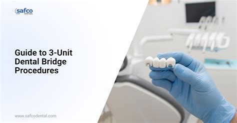 Guide to 3-Unit Dental Bridge | Safco Dental Supply