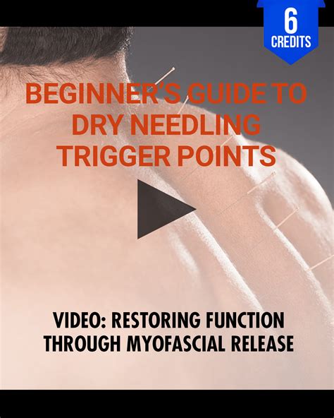 Beginner's Guide to Dry Needling Trigger Points: Restoring Function Th ...