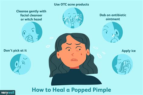 How To Cure A Popped Pimple - Mealvalley17