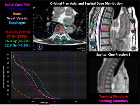 Image result for Calculation Operation Program