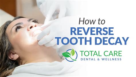 How To Reverse Tooth Decay | Total Care Dental | Holistic Dentistry