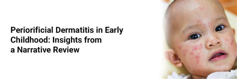 Periorificial Dermatitis in Early Childhood: Insights from a Narrative ...