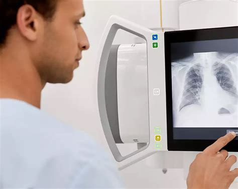 Fluoroscopy systems - Philips