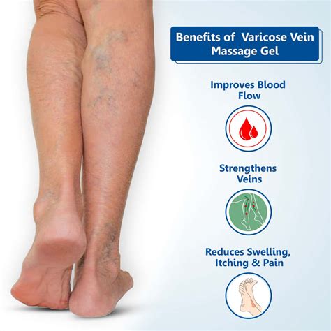 Foot Massage Varicose Veins at Wendy Elkins blog