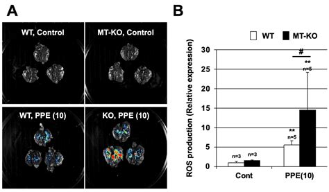 Exacerbation of Elastase-Induced Emphysema via Increased Oxidative ...