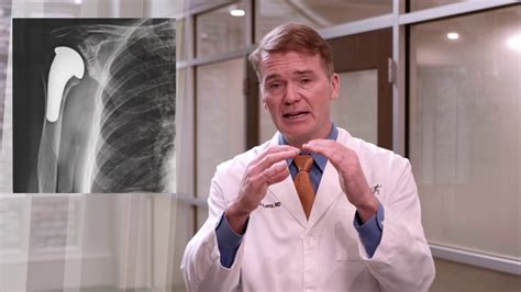 Shoulder Arthritis and Treatment Options - YouTube