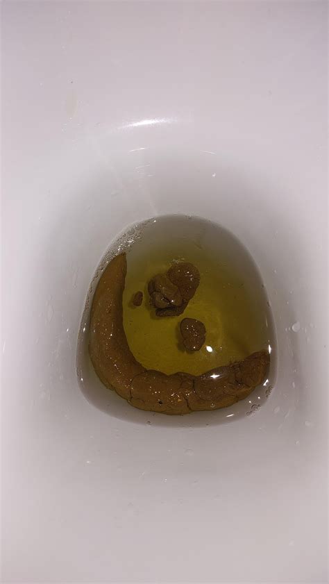 Are these ribbon-like feces? Help : r/poop