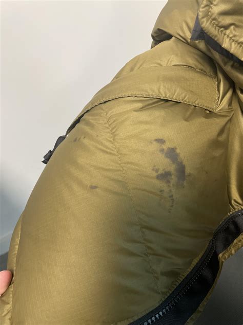 Help getting Vaseline stain out of clothing? Literally just bought this jacket & don’t know what ...